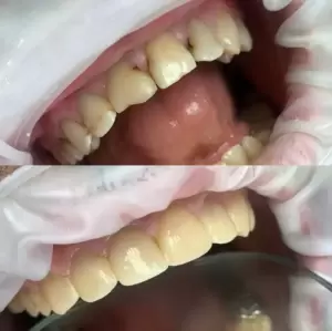 Фотография Диасдент 4